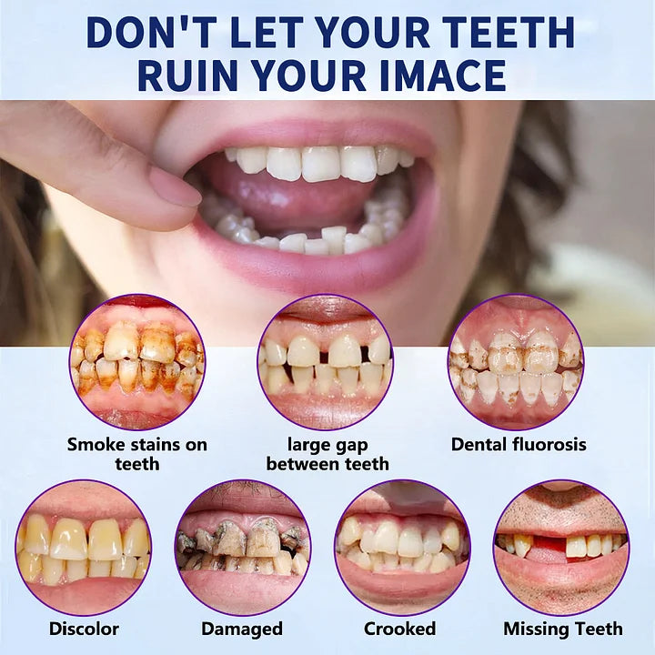 HEATWOLF® - Premium Customized Full Denture Set🦷-🥑🥑The Royal London Dental Hospital accreditation(🏆Limited Time Discount Last 30 Minutes🏆)