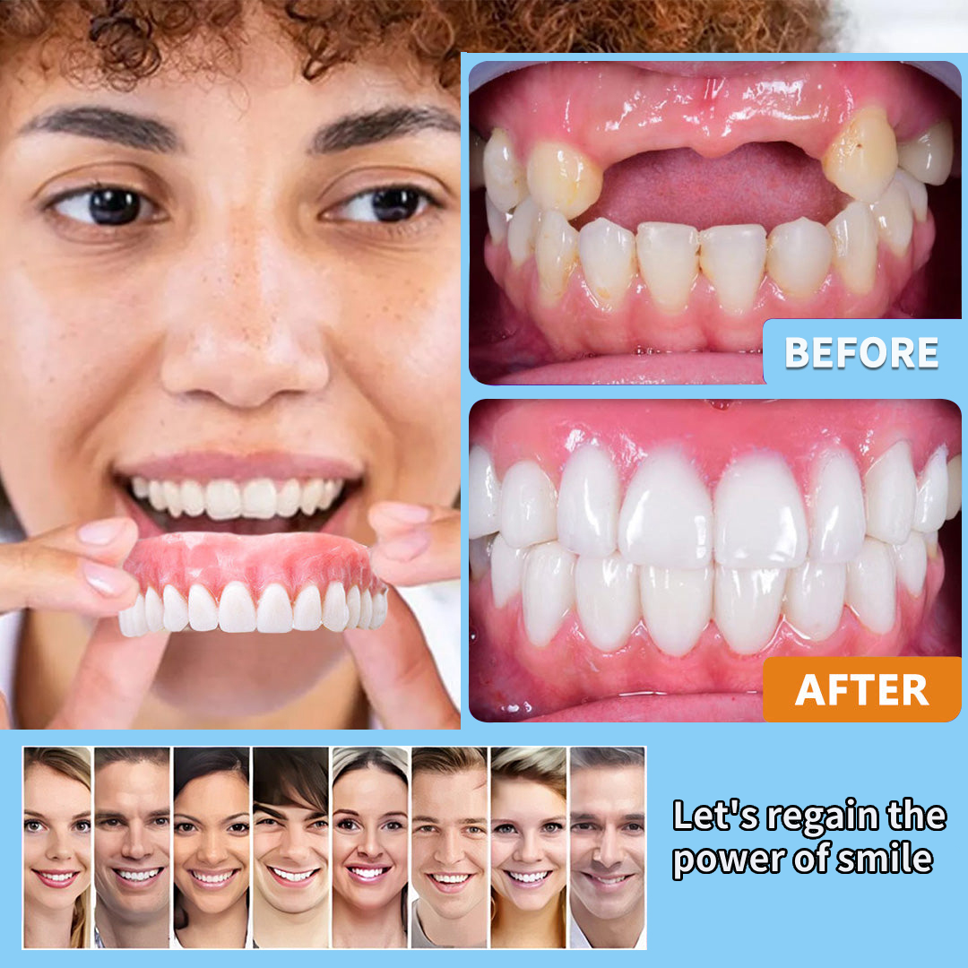 HEATWOLF® - Premium Customized Full Denture Set🦷-🥑🥑The Royal London Dental Hospital accreditation(🏆Limited Time Discount Last 30 Minutes🏆)