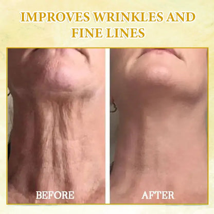 ✨✨𝐋𝐚𝐬𝐭 𝐃𝐚𝐲 𝐃𝐢𝐬𝐜𝐨𝐮𝐧𝐭: 𝟕𝟎% 𝐎𝐅𝐅 LEFUN® SkinFirming Rejuvenating Oil